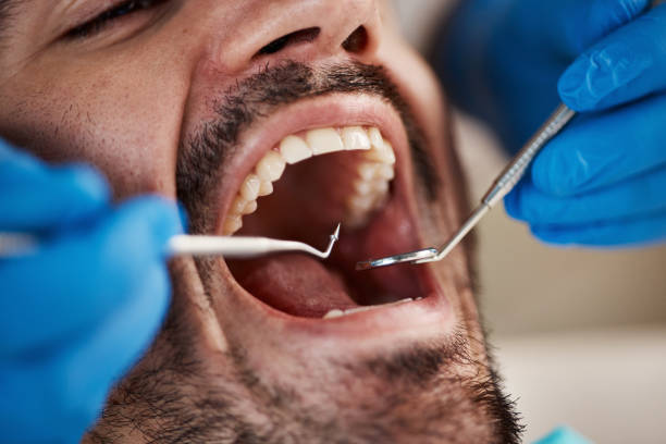 Best Dentist for Tooth Abscess  in Newton, NC