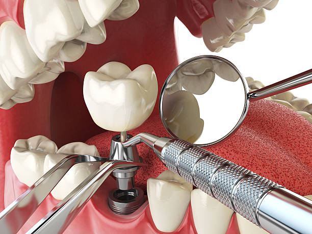 Best Broken Tooth Emergency  in Newton, NC